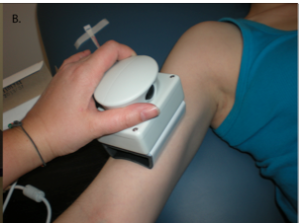 EIM device is noninvasive and painless.