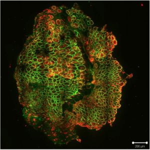 The green color indicates the presence of human spectrin protein, and shows that most of the cells in this muscle taken from a mouse are of human origin.