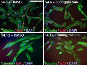 Sunitinib improves the pathogenic phenotype of FSHD myoblasts