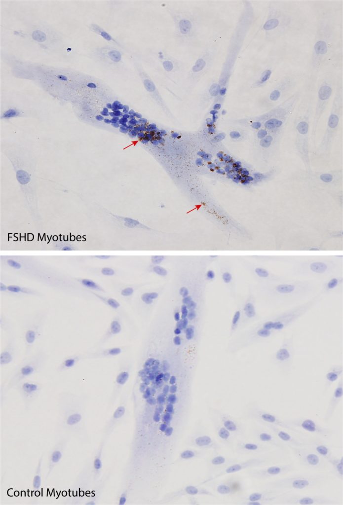 myotubes